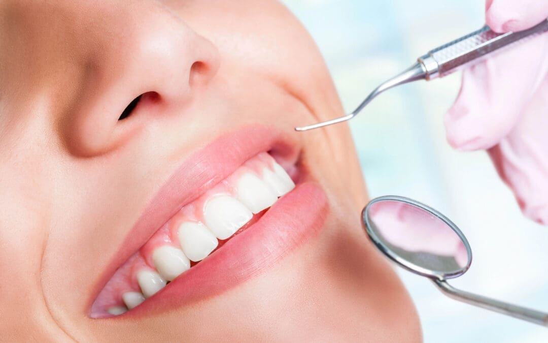 Learn how often you can safely whiten your teeth with professional guidance from Conyers Dental Associates in Conyers, GA.